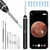 Otoscope HD avec Outil de Nettoyage du Cérumen, 6 LED, Kit de Nettoyage et d'Inspection du Cérumen, Compatible avec les Smartphones iOS et Android (Noir)
