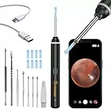 VITCOCO Otoscope pour Enlever le CéRumen, 1920p Wifi Otoscope Oreille, Nettoyage Oreille avec CaméRa, Otoscope avec 6 Led Pour Iphone, Ipad et Smartphones Android pour Adultes, Enfants, animal(Noir)