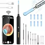 VITCOCO Otoscope Oreille, Camera Oreille Nettoyage 1296P FHD 3,5mm et 6 LED, Nettoyage Oreille IP67 Étanche, Cure Oreille Camera Compatible iOS/Android(Noir)