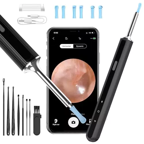 Qimic Otoscope pour oreilles avec caméra 1080P HD et 6 LED, outil de nettoyage