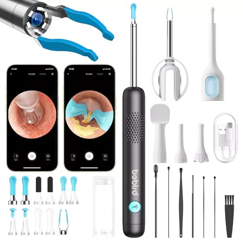 Otoscope Cure Oreille Nettoyage Camera et Lumière, Kit d'Élimination de Cérumen & Scope de Contrôle ORL pour Usage Domestique